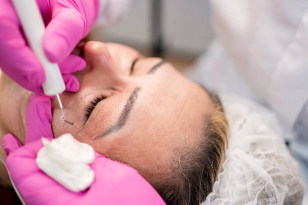 Does Eyelid Surgery Look Natural After Healing?