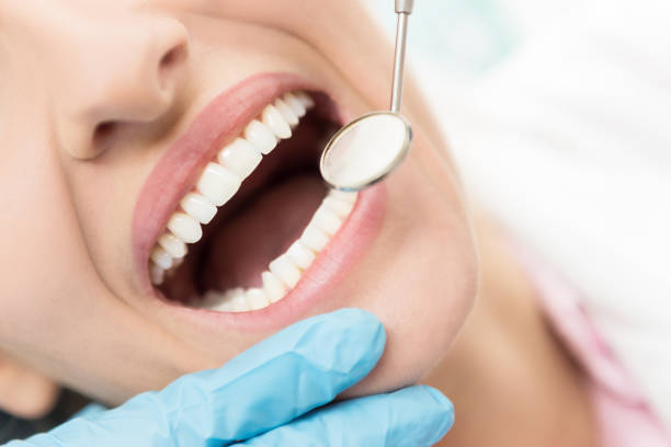 Does Teeth Cleaning Remove Plaque and Tartar