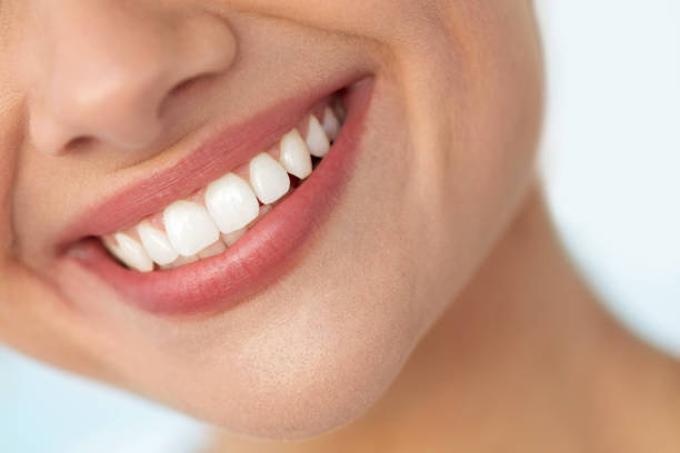 Does Teeth Whitening Damage Enamel Over Time