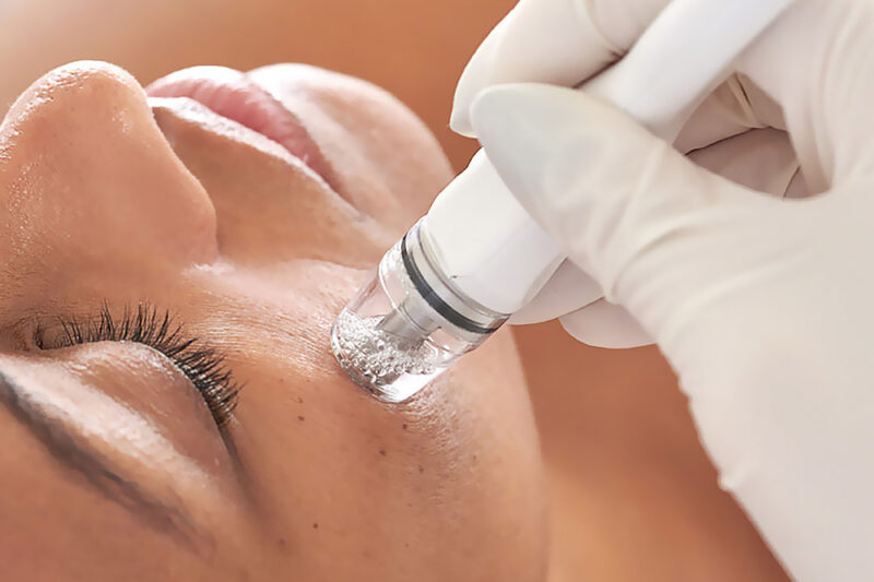 Everything to Know Before Getting Skin Glowing Injections