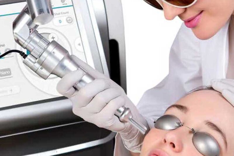 Experience Deep Skin Rejuvenation with Laser Carbon Peeling