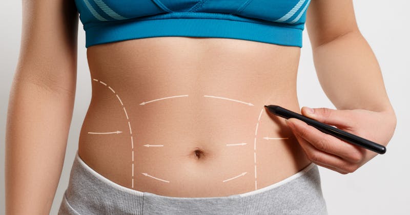 Feel Confident Again with Mini Abdominoplasty