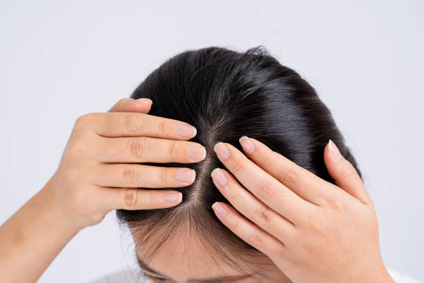 How Effective Is Exosomes Hair Treatment Today