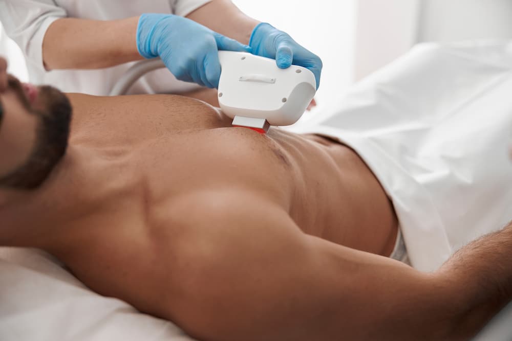 How Effective Is Men’s Laser Hair Removal for Chest