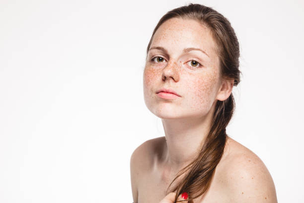 How Long Does Pigmentation Treatment Last