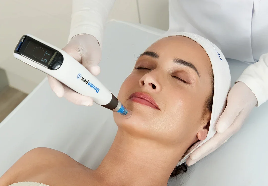 How Many Dermapen Treatment Sessions Needed