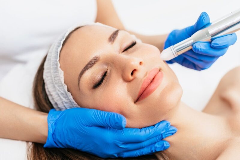 How Soon Do Microneedling Results Appear?