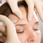 Innovative Botox Solutions for Facial Palsy