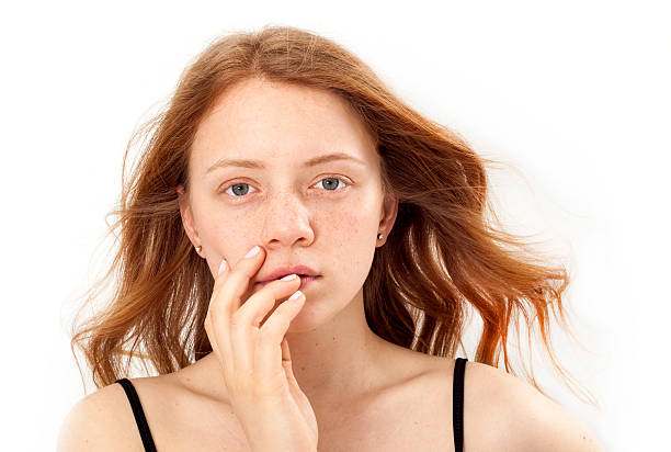 Is Melasma Treatment Suitable for All Skin Types