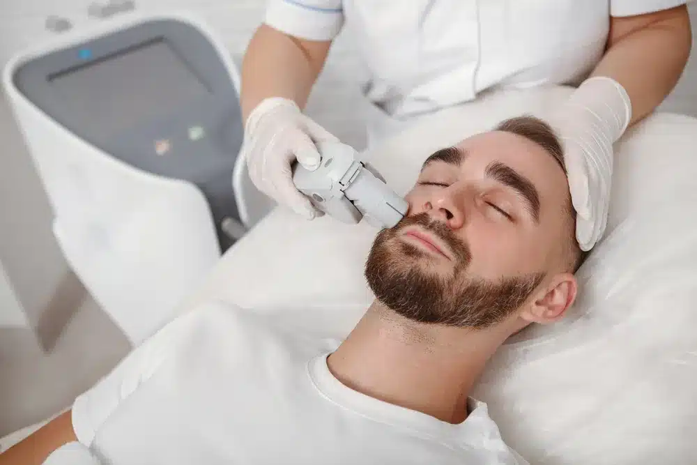 Is Men’s Laser Hair Removal Good for Beard?