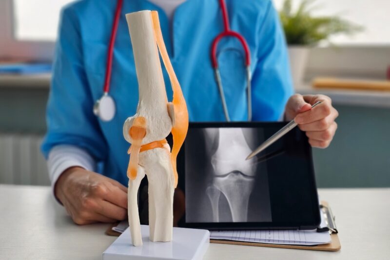 Wie man den besten Orthopäden in Berlin auswählt
