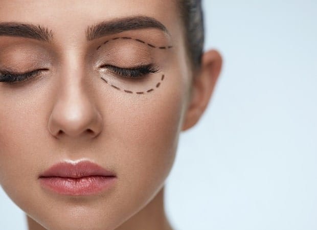 Restore Confidence with Eyelid Surgery