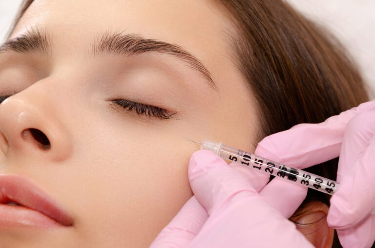 Smooth Facial Lines with Anti‑Wrinkle Injections