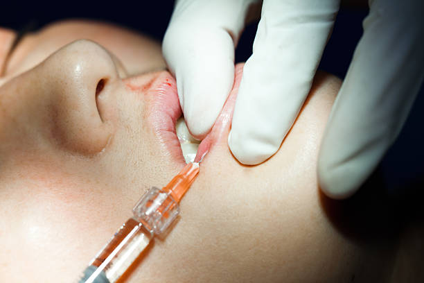 What Makes Lip Fillers So Popular Today