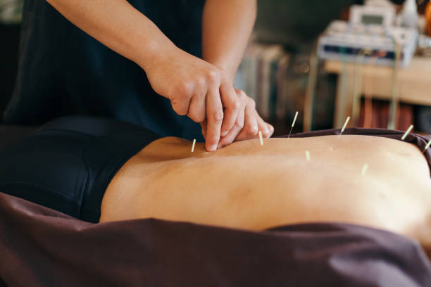 acupuncture in New Westminster