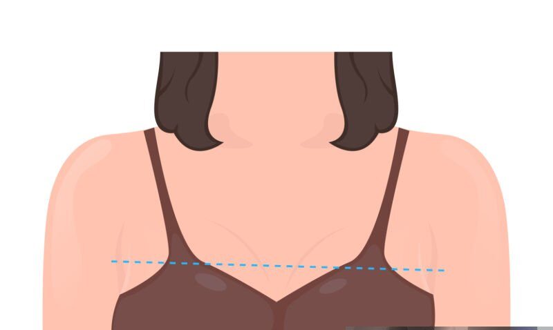 Everything You Need to Know Before Getting Breast Symmetry Correction Surgery