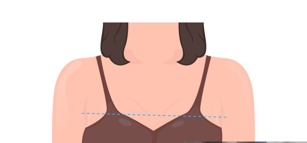 breast asymmetry surgery