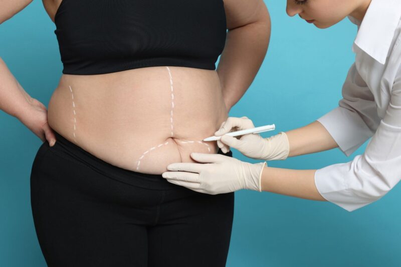 كيف تحافظين على النتائج بعد جراحة تكبير الثدي؟