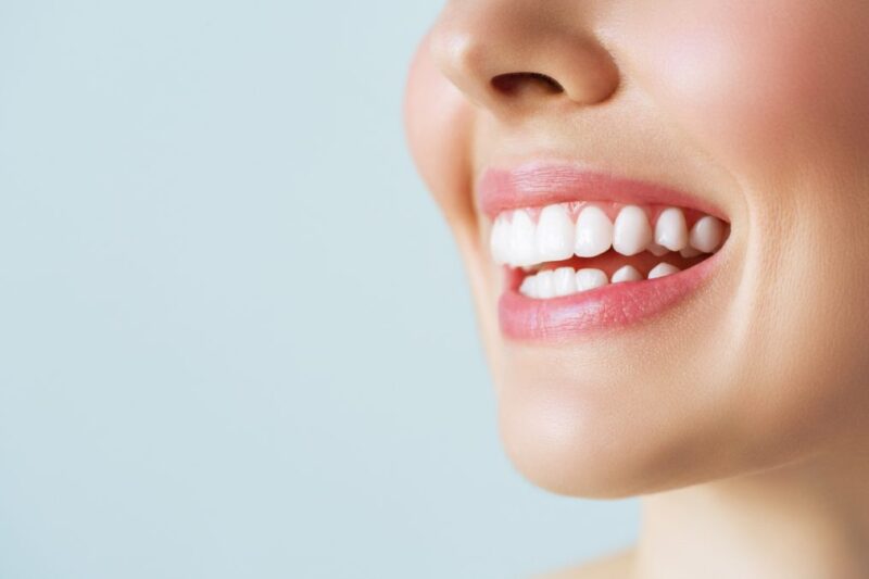 كيف يُمكن الحفاظ على نتائج تبييض الأسنان بعد جلسات التبييض؟