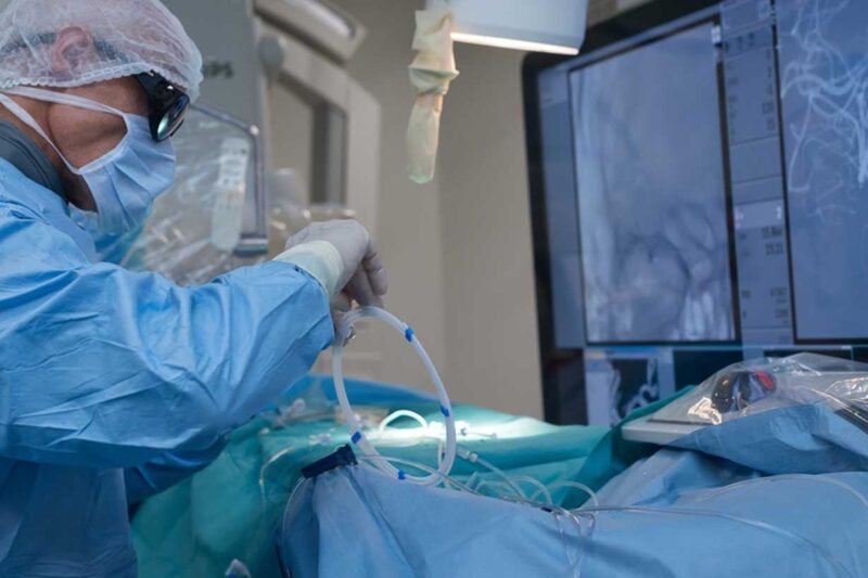 ما مدى شيوع جراحة الأوعية الدموية عالميًا؟