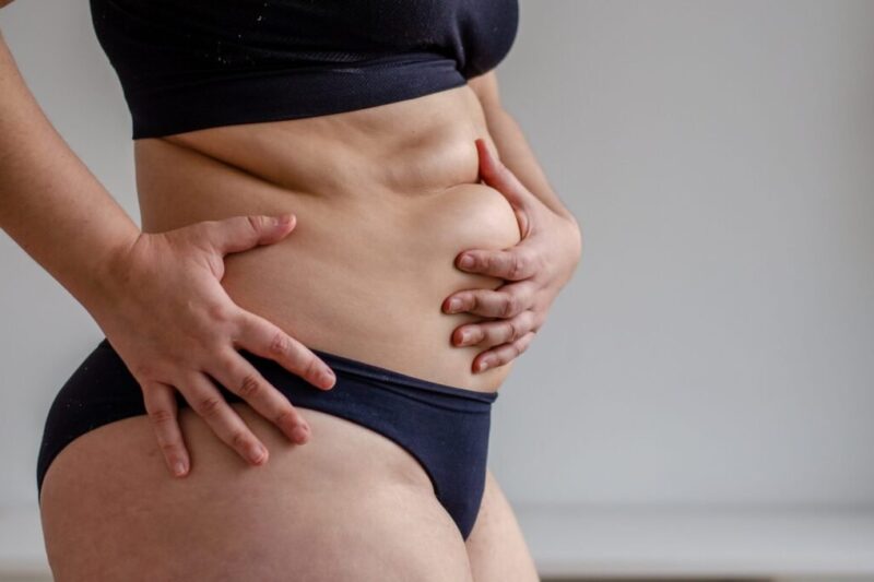 ما هي فوائد جراحة شفط الدهون بتقنية 4D بالفيزر؟