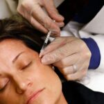 Mesotherapy Treatment in Dubai