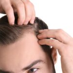How Does Hair Loss Treatment Improve Scalp Health
