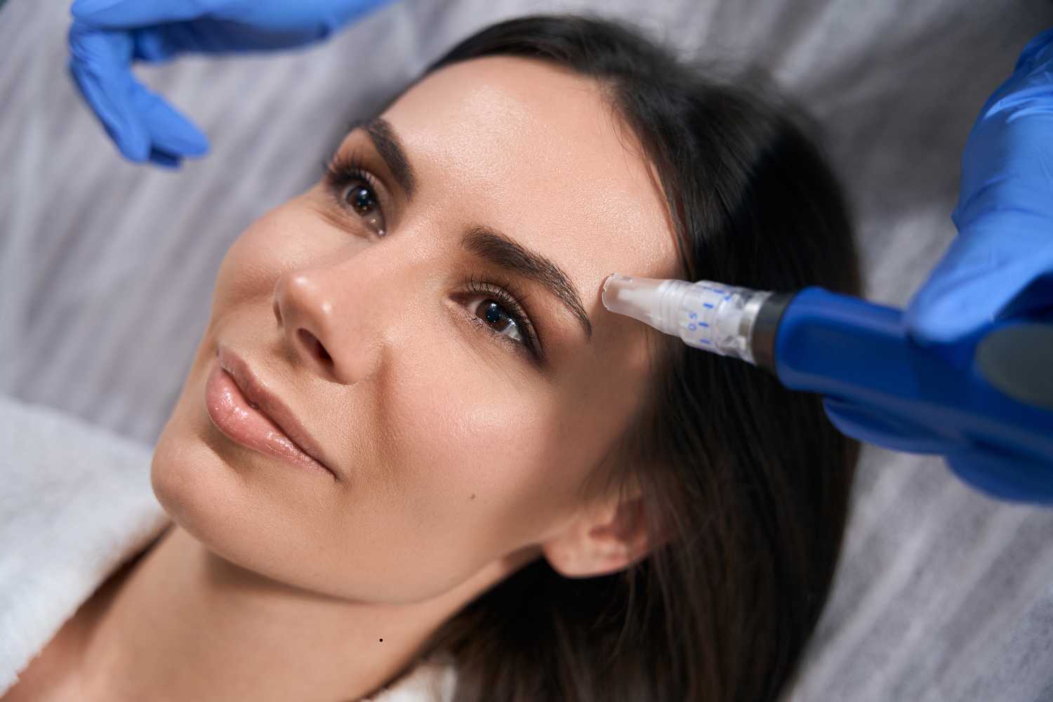 How Does Microneedling Brighten Dull Skin?
