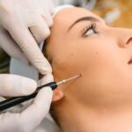 How Long Does Mole Removal Take to Heal?