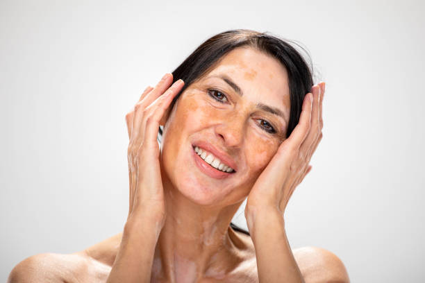 How Pigmentation Treatment Combines With Other Skin Care