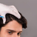 How Soon Will You See Results From PRP Hair Treatment