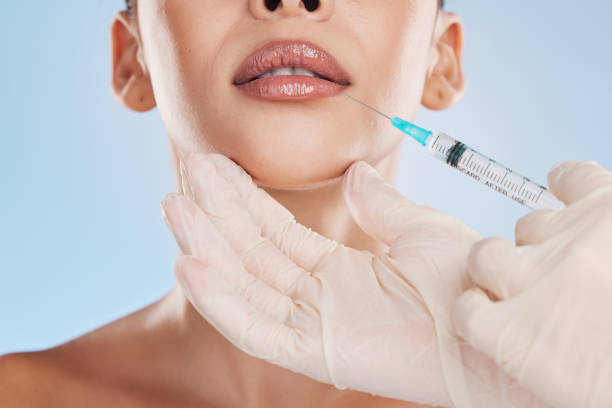 How to Recover Quickly After Lip Fillers Injection