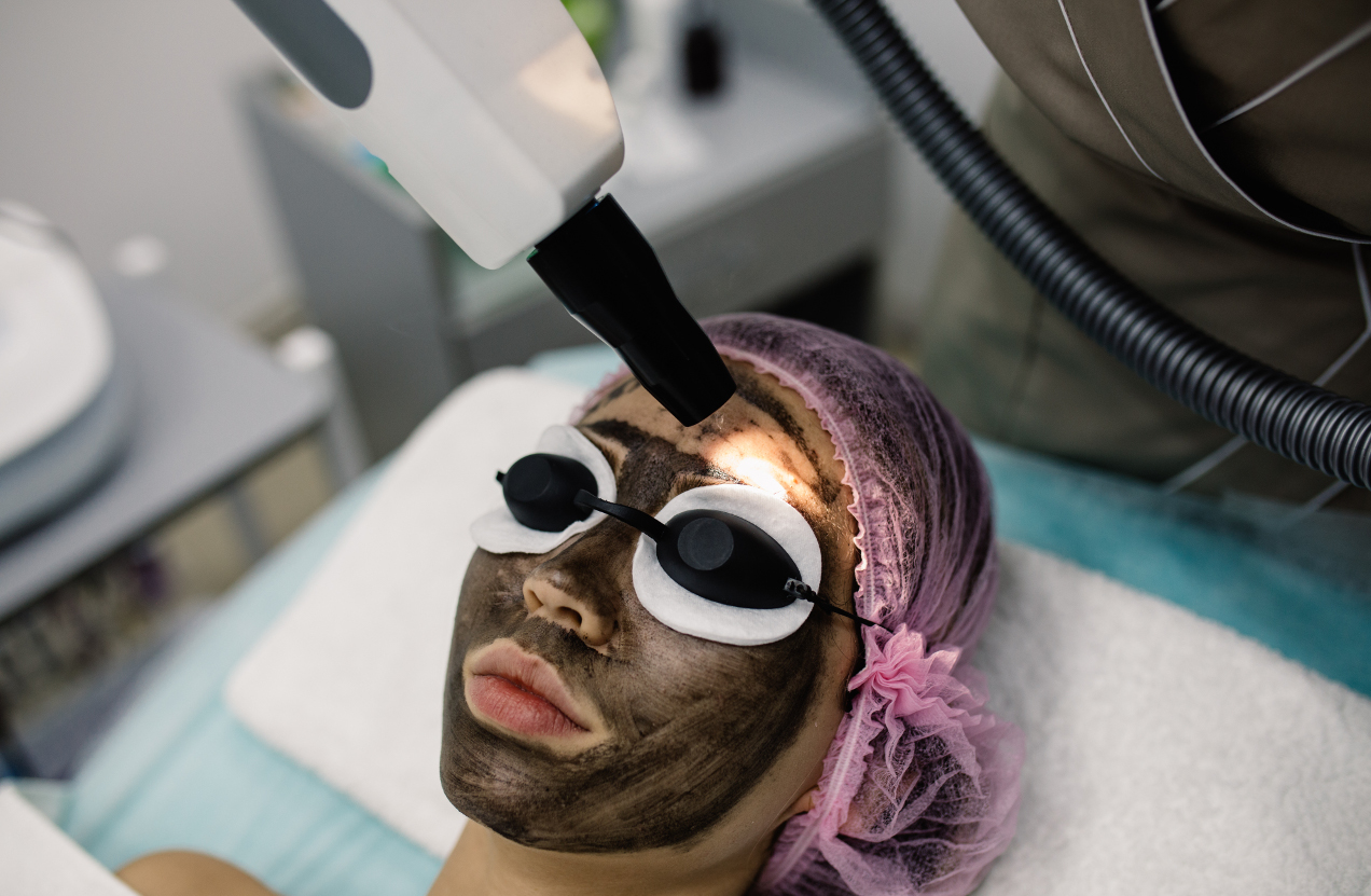 Laser Carbon Peel Dubai