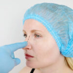 Is Rhinoplasty Suitable for All Skin Types