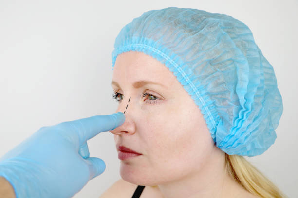 Is Rhinoplasty Suitable for All Skin Types