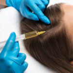 Is the Best PRP Hair Treatment Worth It