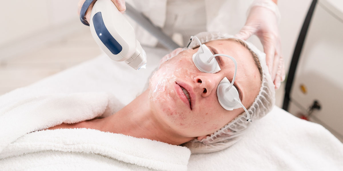 Renew Your Skin with Laser Acne Scar Therapy