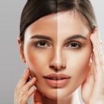 تبييض البشرة في دبي