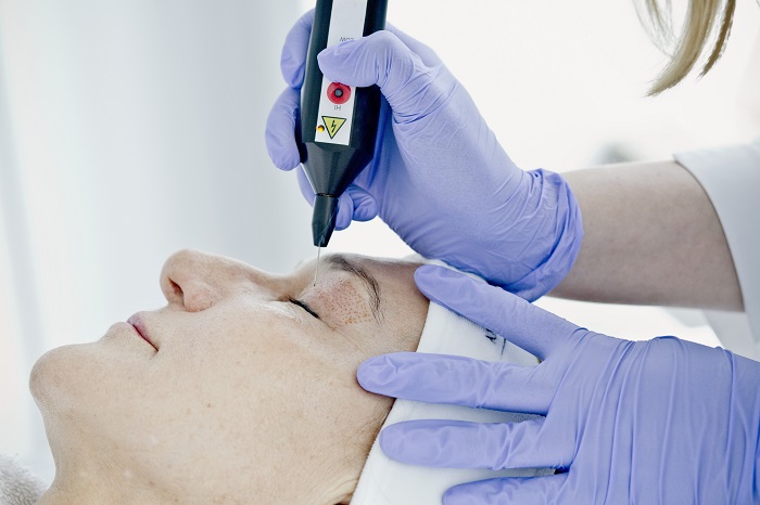 Plexr Plasma Eye Lift in Dubai