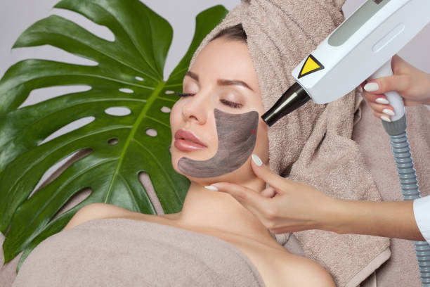 What Laser Carbon Peel Does for Skin Rejuvenation