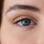 Who Is the Right Candidate for Eyelid Surgery