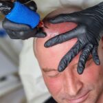 صبغ فروة الرأس المجهري أبوظبي