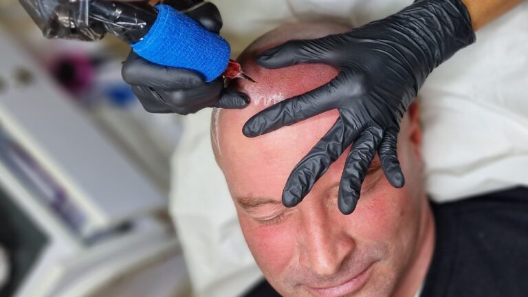 صبغ فروة الرأس المجهري أبوظبي