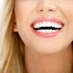 هل تبييض الأسنان مناسب لجميع الأعمار؟